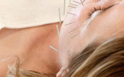 The beauty of Cosmetic Acupuncture