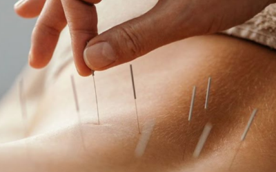 Acupuncture for Mental Health & Well-Being